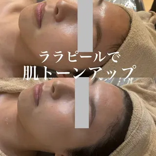 WHITE AQUA 北千住店のエステ・リラクイメージ