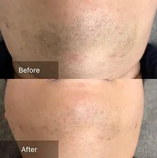 MARIRE EPISALONのエステ・リラクイメージ