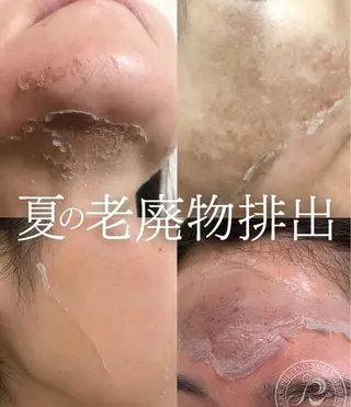 Liberte リベルテ(トモ化粧品店内)所属・Liberte🍒 RINAのマツエク・マツパデザイン