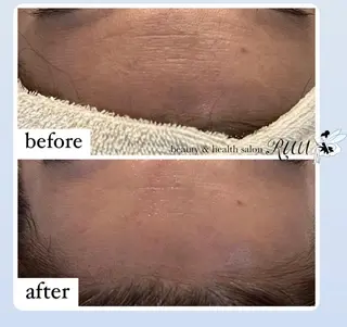 【頭痛、睡眠改善】 salon RUUのエステ・リラクイメージ