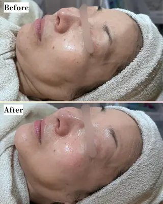 s o i n a🤍🪽ララピール／毛穴／小顔／水光肌所属・s o i n a 神楽坂のエステ・リラクイメージ