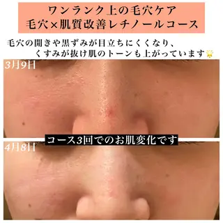 Bellesthe (ベルエステ)のエステ・リラクイメージ