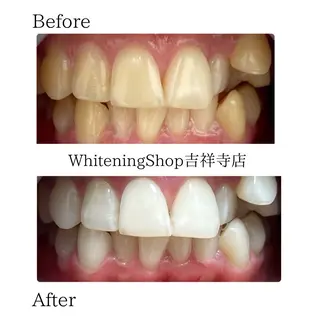 ホワイトニング ショップ吉祥寺店のエステ・リラクイメージ