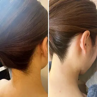 うなじ脱毛/美肌脱毛 LABELのエステ・リラクイメージ