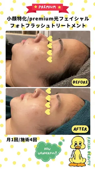 blue.【都度払い脱毛&フェイシャルサロン】所属・blue.💙【 脱毛&フェイシャル】のエステ・リラクイメージ