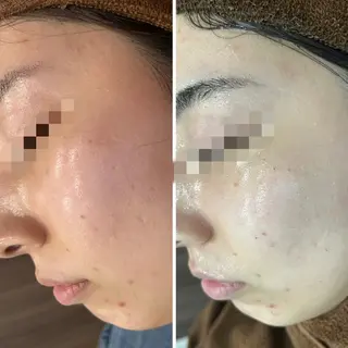 セミロング カラー パーマ ヘアアレンジ メンズ キッズ ネイル マツエク・マツパ アイブロウ Amaryllis 🌹松本のエステ・リラクイメージ