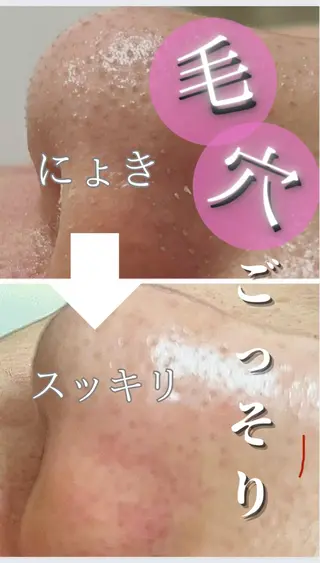 RAY Beauty エステ　一宮店のエステ・リラクイメージ