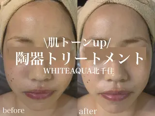 WHITE AQUA 北千住店のエステ・リラクイメージ