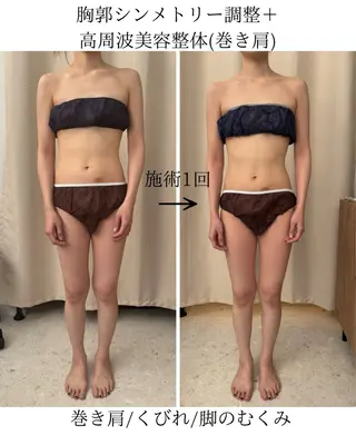 ANZ美容整体所属・美姿勢|痩身|目黒 ANZ-美容整体-のエステ・リラクイメージ