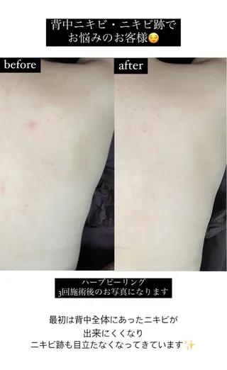 ベラージュ【美背中・ 美尻・フェイシャル】のエステ・リラクイメージ