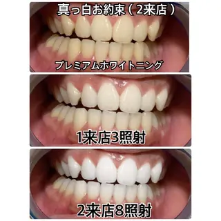 メンズ プラチナムビューティー柏所属・【歯科提携】柏ホワイ トニングスタイルのその他イメージ