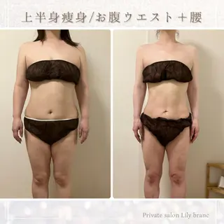 Lily branc 痩身/小顔/肌質改善のエステ・リラクイメージ