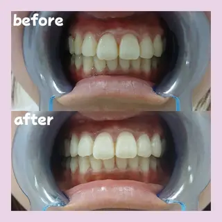 セルフホワイトニングサロンPalet【パレ】所属・太田 菜那のその他イメージ