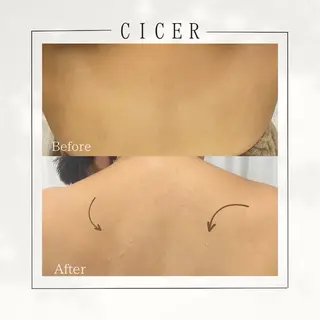 cicerよもぎ蒸し所属・cicerよもぎ蒸し ハーブピーリングのその他イメージ