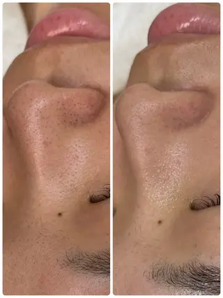 デ・アイム赤城所属・ナリス化粧品🌹 saoriのエステ・リラクイメージ