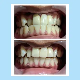 お手軽ホワイトニングsalon mina所属・武元 奈津美のその他イメージ