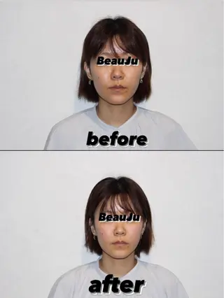 美容鍼灸整体サロンBeauJu所属・小顔矯/美容鍼/鍼灸 BeauJuのその他イメージ