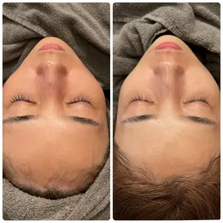 yellow.所属・yellow💛【 脱毛&フェイシャル】のエステ・リラクイメージ