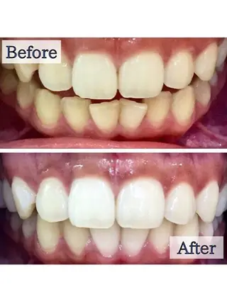 LBSホワイトニング上野店所属・LBSホワイトニング 🌐 上野店公式のエステ・リラクイメージ