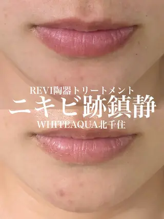 WHITE AQUA 北千住店のエステ・リラクイメージ