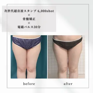 小顔矯正専門店 【RED】池田のエステ・リラクイメージ