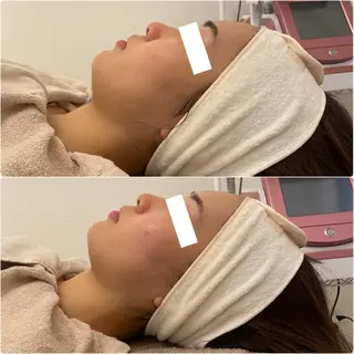 ✨美肌水光✨ アトリエリュバンのエステ・リラクイメージ