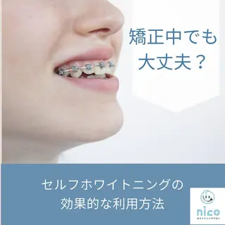 セミロング ホワイトニングサロン nico西葛西店のその他イメージ