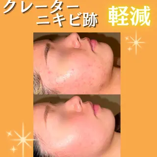 🫧ビュースタ 伊藤🫧のエステ・リラクイメージ