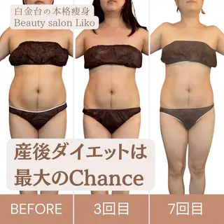LIKO ボディのエステ・リラクイメージ