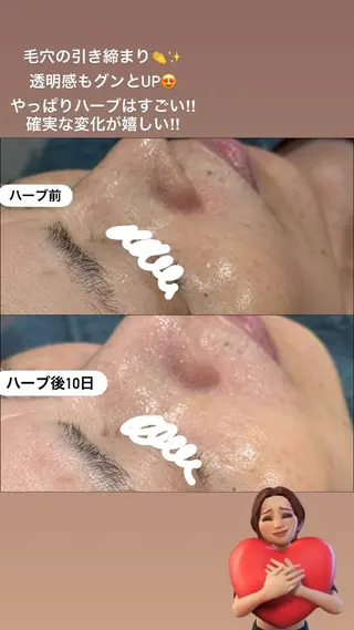 LiZA エステティックサロンのエステ・リラクイメージ