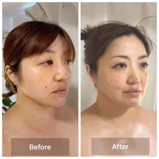 LaLa所属・小顔・たるみケア 専門店【LaLa】のエステ・リラクイメージ