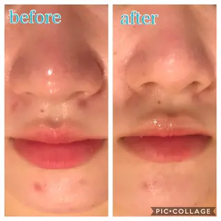 ミディアム カラー パーマ ヘアアレンジ キッズ ネイル マツエク・マツパ Ensor Clair所属・EnsorClair 代表 野口真央のエステ・リラクイメージ