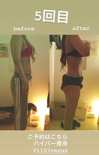 女性のお悩み美容 サロン　ヴィーナスのエステ・リラクイメージ