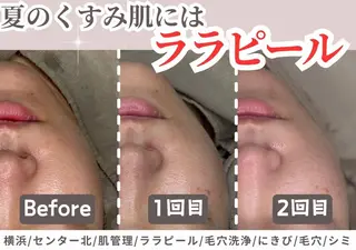 sii センター北 AIのエステ・リラクイメージ