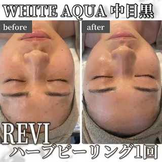 中目黒ハーブピーリン グ🌿ララピールのエステ・リラクイメージ