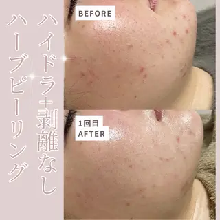 プライベートサロン Belle(ベル)のエステ・リラクイメージ