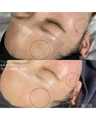 Étoile Bebeのネイルデザイン