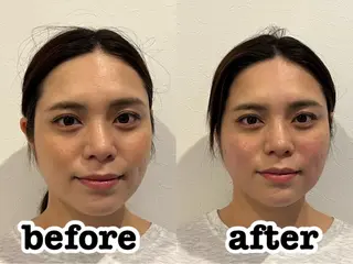美容鍼灸Solana所属・小櫻 唯のエステ・リラクイメージ