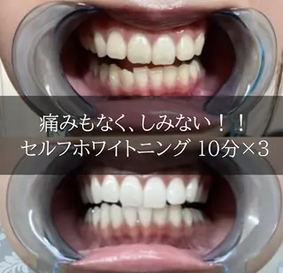 ホワイトニング専門店 LCS 銀座店 峰岡のその他イメージ