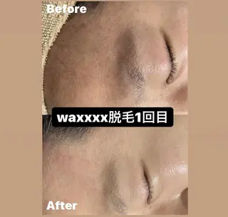 Epina 千葉店 【エピナ】のエステ・リラクイメージ