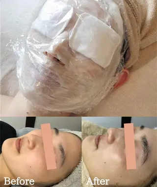 BestBelleꕤ 大阪福島/肌質改善のエステ・リラクイメージ