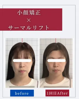 小顔矯正専門店 ❤️池田 桃花のエステ・リラクイメージ