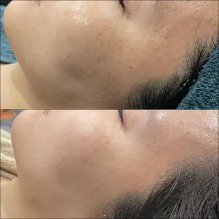 LiZA エステティックサロンのエステ・リラクイメージ