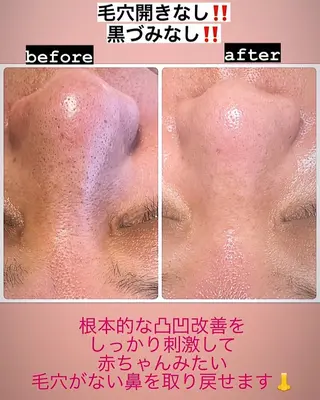 ショート カラー パーマ ヘアアレンジ メンズ ネイル マツエク・マツパ アイブロウ ビューティーサロンRavi所属・ビューティーサロン Raviのエステ・リラクイメージ