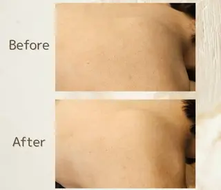 &W アンダブルのエステ・リラクイメージ