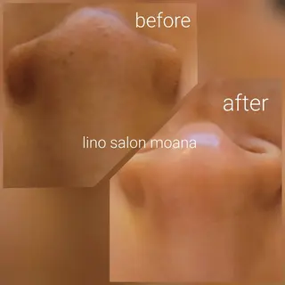 lino salon moana所属・lino salon  moanaのエステ・リラクイメージ
