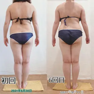 むくみ専門痩身 マクイエステティックのエステ・リラクイメージ