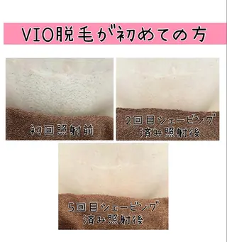 毛穴改善/脱毛 ネイル 川上久仁子のエステ・リラクイメージ