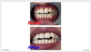 セルフホワイトニングサロン　ラヴィアン所属・ホワイトニングサロン La vie enのその他イメージ