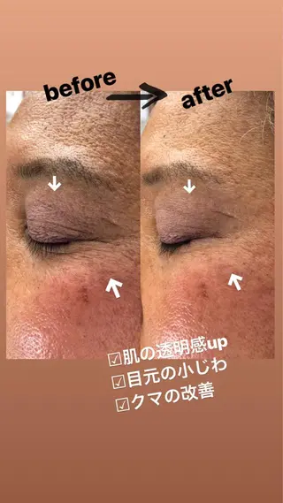 美容鍼・鍼灸専門❤✨ 近藤めぐみのエステ・リラクイメージ